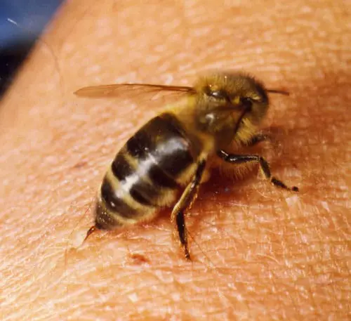 Picadura de abeja